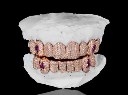 CUSTOM MOISANNITE DIAMOND GRILLZ in 10K SOLID GOLD